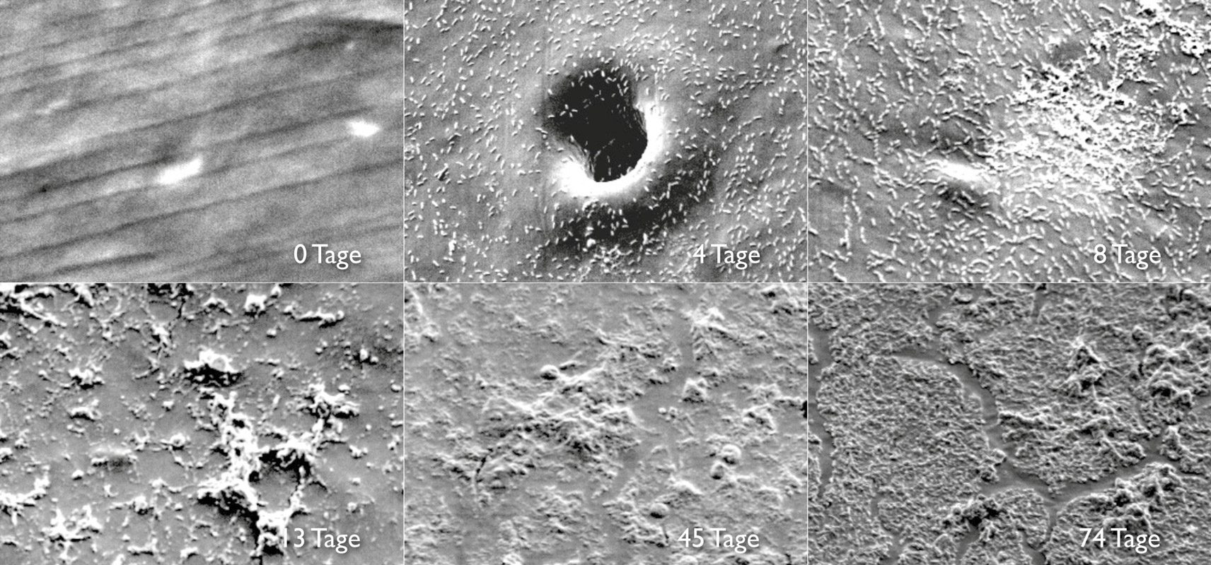 biofilm_aufwachsen_auf_schlauchoberfläche_unter_mikroskop